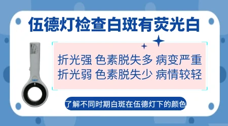 伍德灯下白癜风开始是什么样图片