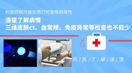 伍德灯确诊白斑的准确度高不高