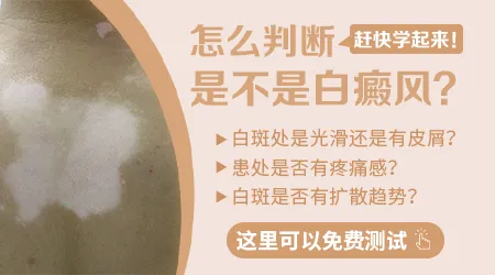 如何自我判断是不是白癜风