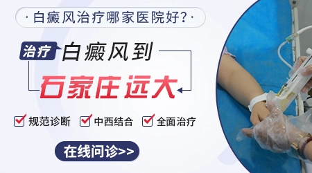 石家庄哪家医院做白癜风手术好