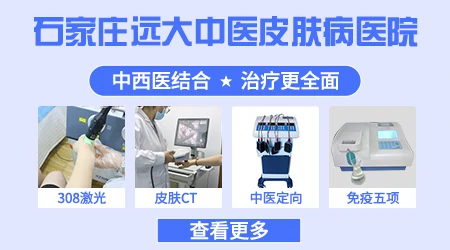 石家庄能治白癜风的专科医院哪家好