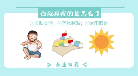 白癜风涂药后皮肤发红刺痒是过敏还是正常反应