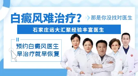 石家庄有没有治疗白癜风很好的医生