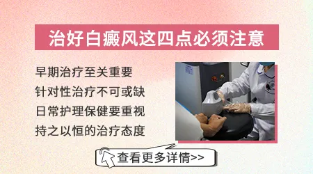 白癜风早期用什么药能治好