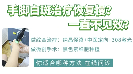 手脚上的白癜风白斑为什么周期相对长一些