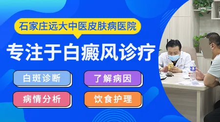 白癜风到底怎么才能消除