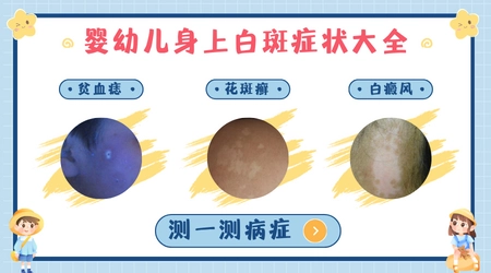 四岁宝宝脸上长白斑怎么办