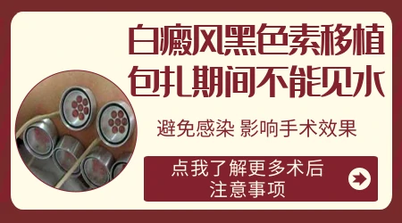 黑色素种植治疗白癜风好吗