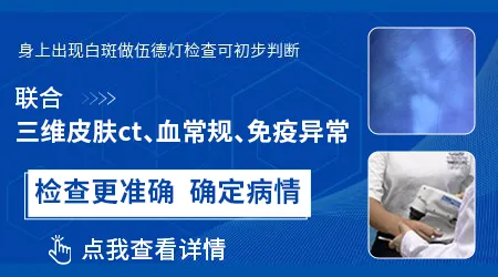 伍德灯检查能区分花斑糠疹和白癜风吗