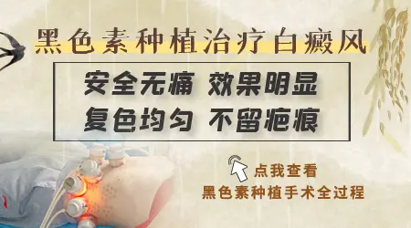 白癜风种植黑色素效果好吗