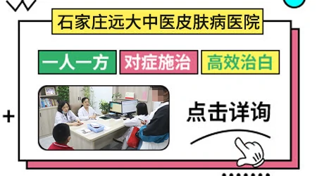 如何区分白癜风白斑初期和其他皮肤病
