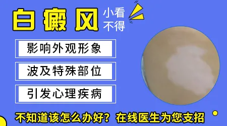 腿上莫名出现不痛不痒的白块是什么原因