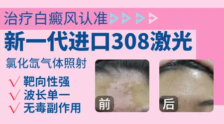 军训暴晒后脸上长白点是不是白癜风