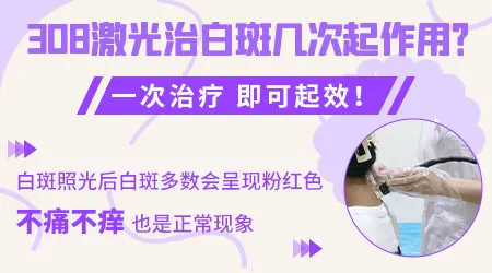 白癜风照308激光大概需要多少钱