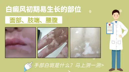 白癜风的白斑会出现在嘴唇上吗