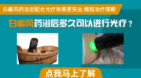 色素减退斑照窄谱uvb效果怎么样