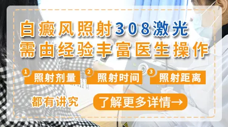 美国308准分子激光光疗仪多少钱一台