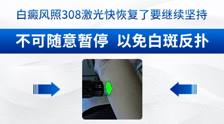 婴幼儿脸上的白斑能照308激光吗