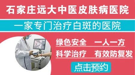 石家庄哪家医院专门治白癜风