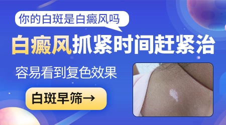 补骨脂酊治疗白癜风效果怎么样