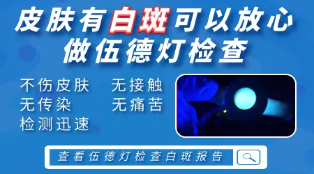 伍德灯下白癜风和普通白斑图片对照
