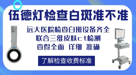 伍德灯检查白癜风准不准 会误诊吗