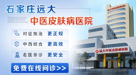 石家庄哪个医院看皮肤白斑好