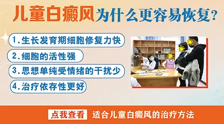 儿童手背上长白斑是什么情况