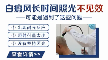白癜风照激光几次没好转就是治疗无效