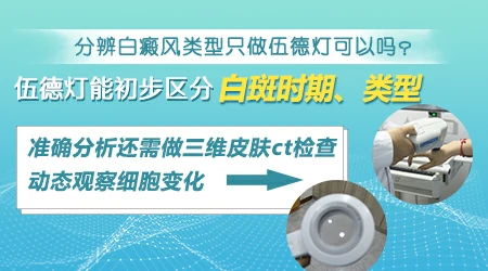 白癜风半年没扩散是不是属于稳定期