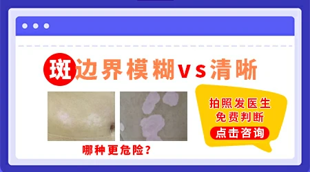 白斑边缘开始变模糊是要扩散吗