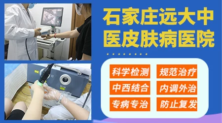 石家庄有哪些白癜风专科医院