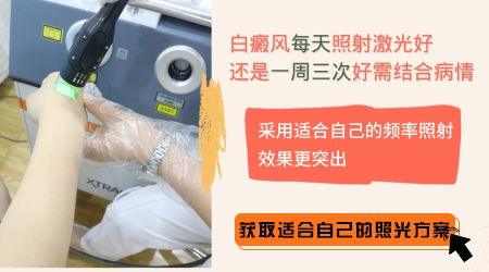 白癜风照激光几次没好转就是治疗无效