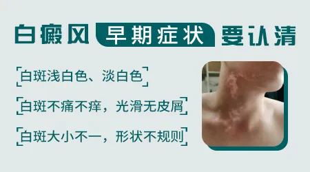 白癜风前期的症状图片