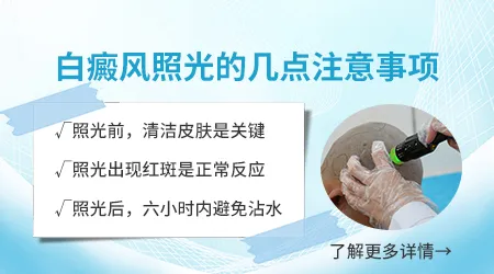 308准分子激光治疗白癜风效果如何