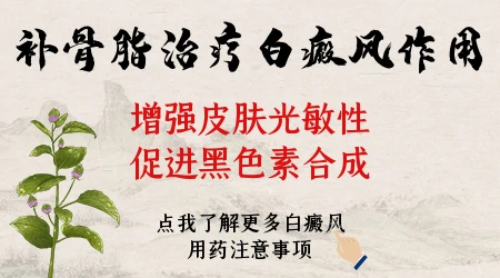 白癜风用补骨脂酊需要配合光照吗
