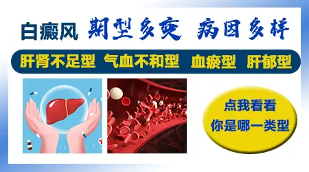 石家庄哪个医生治疗白癜风有名
