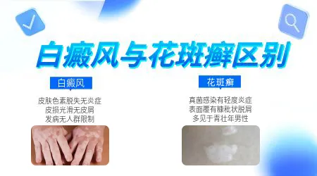 腋下汗斑和白癜风的区别图片对比