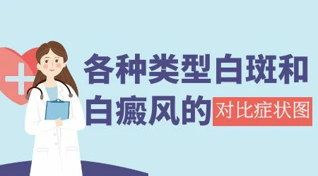 女性面部白癜风早期症状图片