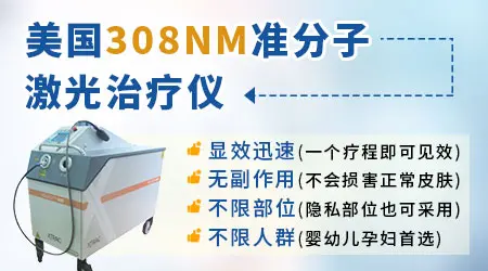 2岁宝宝大腿上有一小块白怎么回事