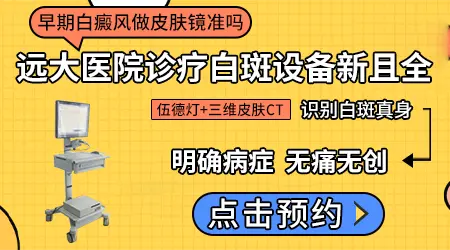皮肤镜鉴别白癜风的准确率高吗