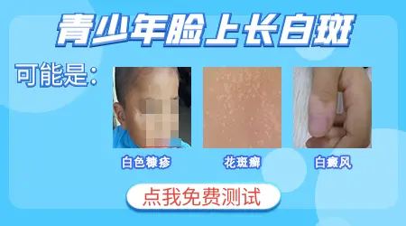 青年身上出现许多白点点是为什么