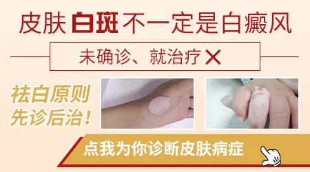 脸上出现好多白斑怎么回事