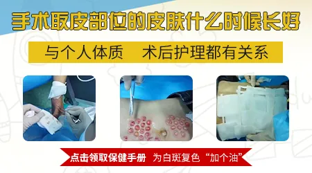 白癜风手术取皮区会不会留疤
