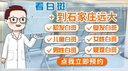 石家庄治疗儿童白癜风去哪里