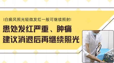 白癜风照完光皮肤只是微微发红是不是说明剂量不够