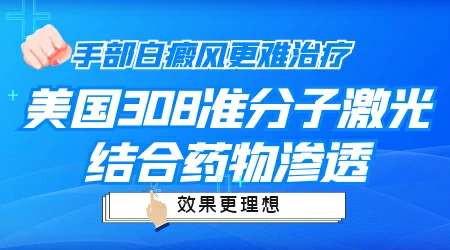 手部白癜风用308激光治疗效果好不好