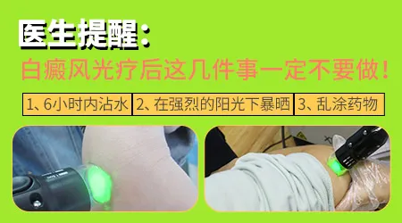 白癜风照家用光疗仪和医院的光疗效果一样吗