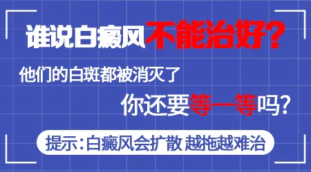 白癜风这个真的能治好吗