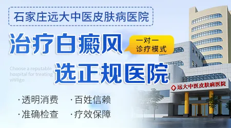 石家庄哪个医院看白癜风看得好